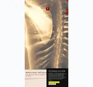 Kleine Seitenvorschau von lymph-liposuktionszentrum.de
