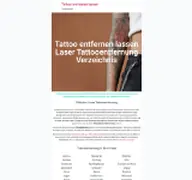 Kleine Seitenvorschau von tattoo-entfernen-lassen.de