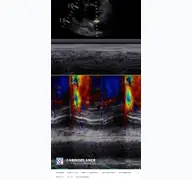 Kleine Seitenvorschau von cardioplaner.de